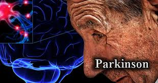 parkinson