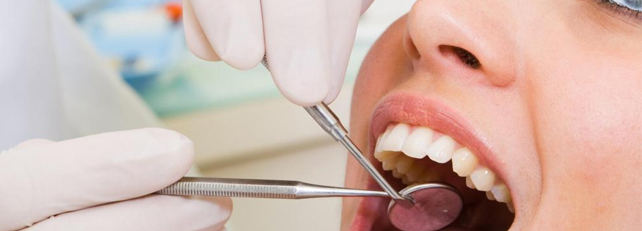 estrazione dente